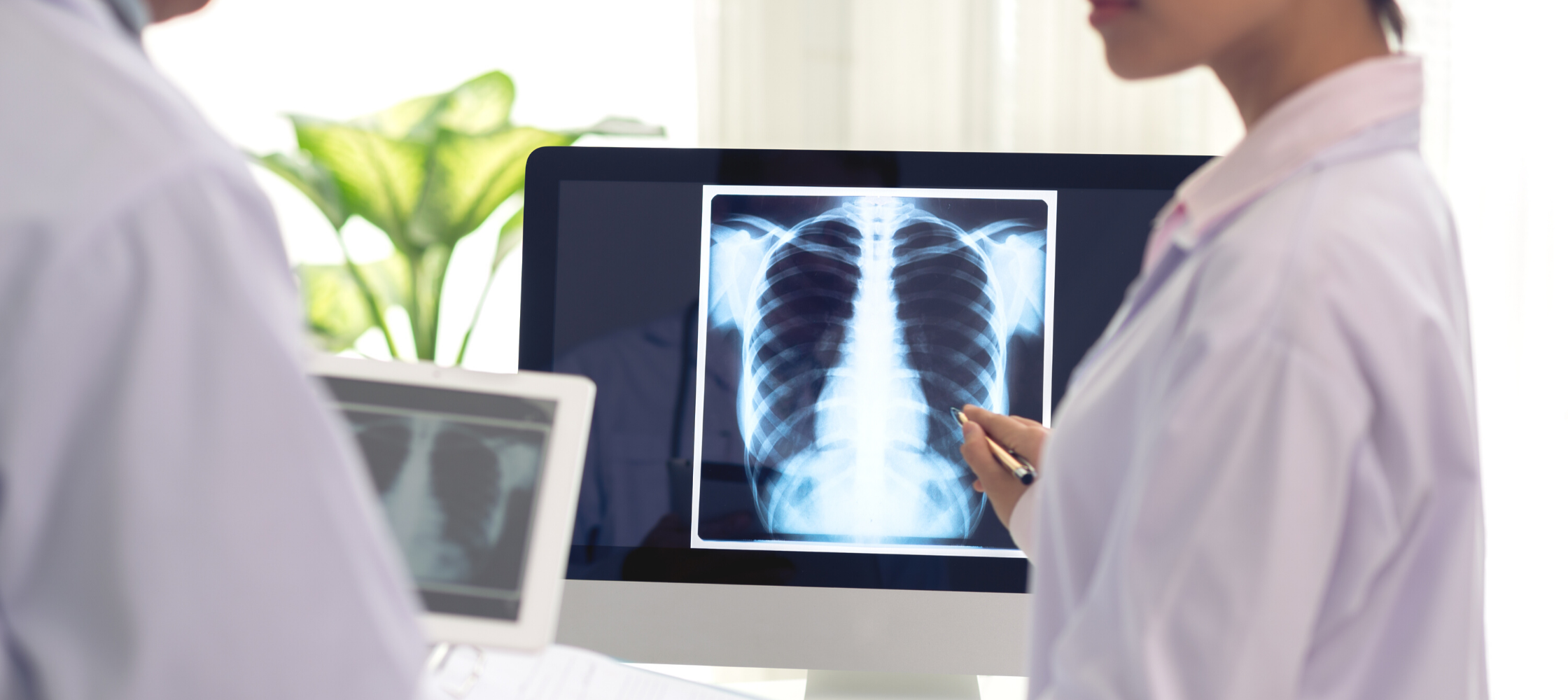 Mobile XRay Systems Pros, Cons, and Costs